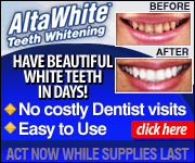 AltaWhite - Teeth Whitening - Washington