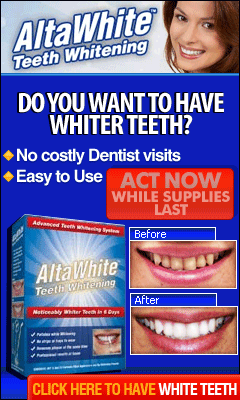 AltaWhite - Teeth Whitening - Pasadena