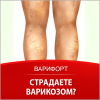 Варифорт - Лечение Варикоза - Хабаровск