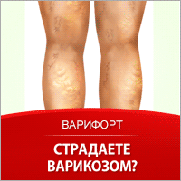 Варифорт - Лечение Варикоза - Верхнеяркеево